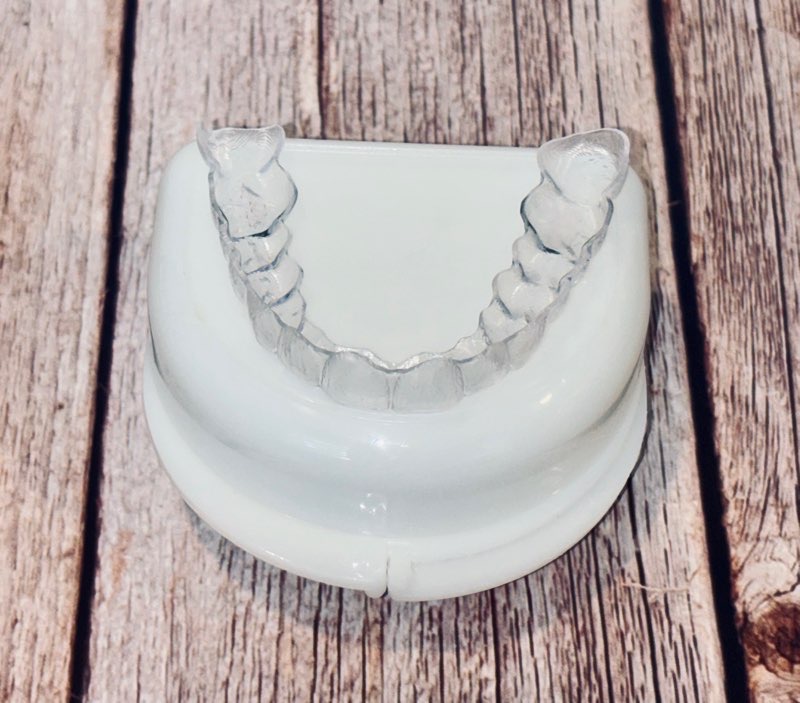 Biological Clear Aligners Image