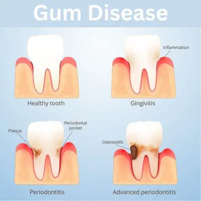 Preventative Dentistry Image